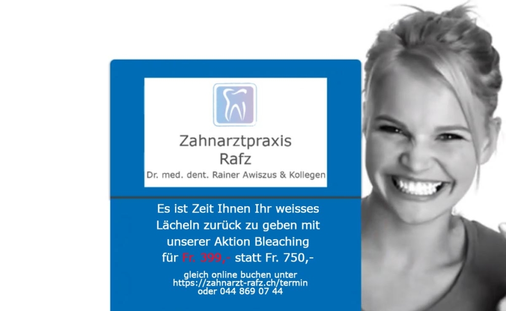 Bleaching, Zahnaufhellung, Verfärbungen, Kaffee, Tee, Rotwein, Tabak, Zahnaufhellungskonzept, Zahnaufhellungsgel, UV-Licht, LED-Licht, Lippen, Zahnfleisch, Biologie, Ernährung, Vorbeugung, Empfindlichkeiten, Kosten, zahnärztliche Behandlung